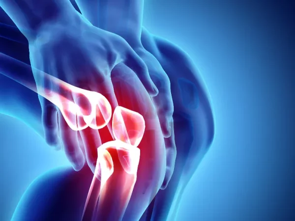 Arthrose: bien manger, un traitement naturel au quotidien Arthrose: bien manger, un traitement naturel au quotidien